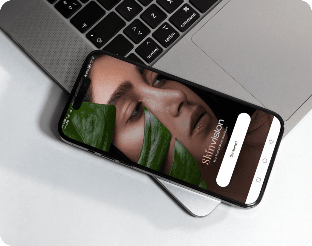 SkinVisions